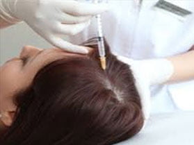 PRP Treatment for Hair Loss