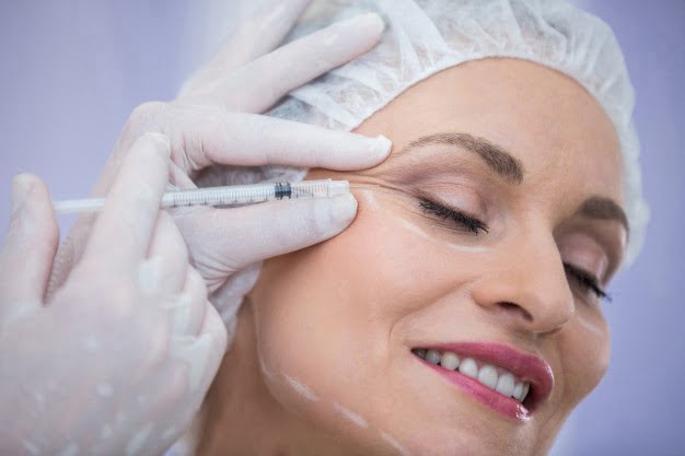 Some Common Myths About Botox Treatment