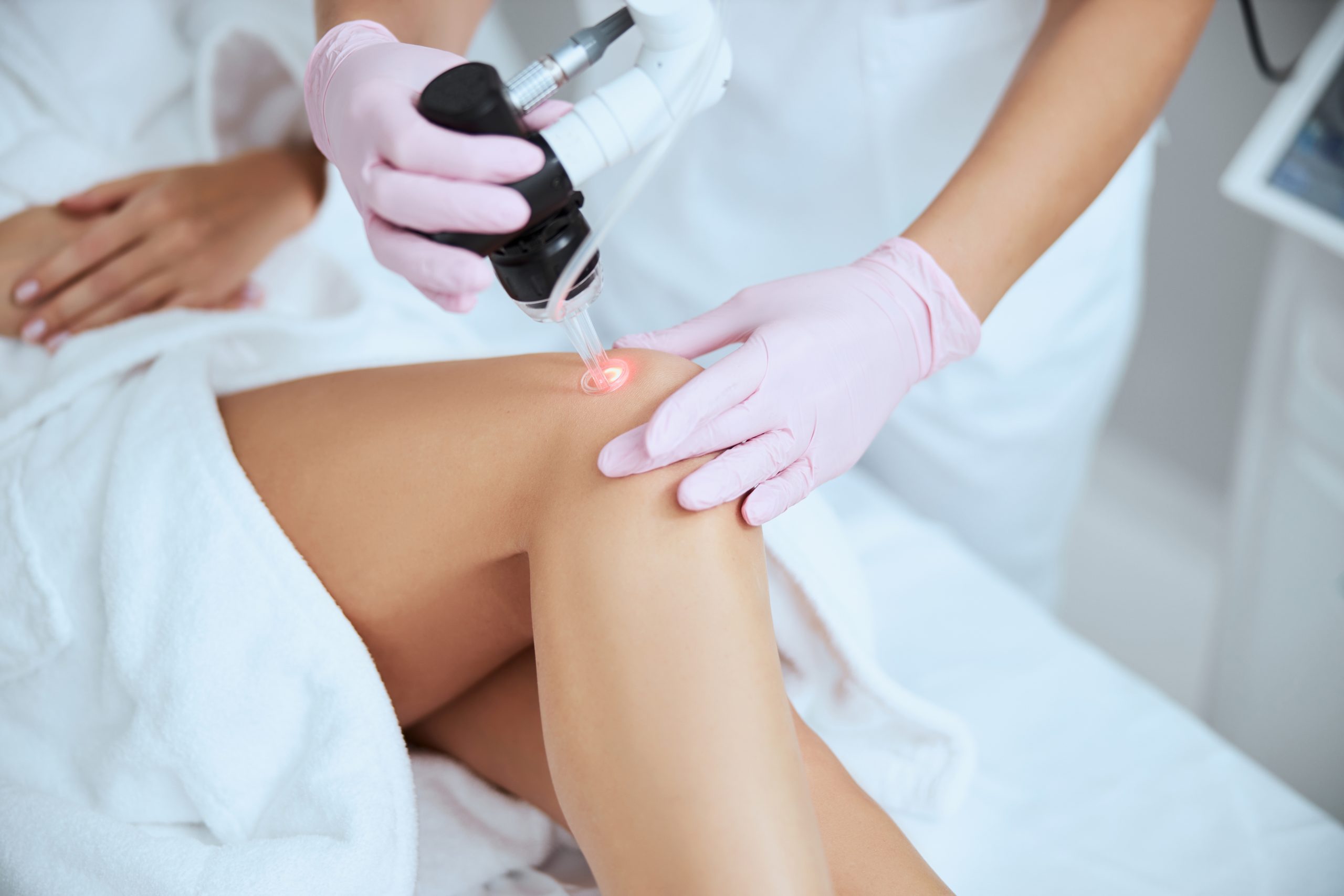 How Spider Veins Treatment Can Enhance Your Looks
