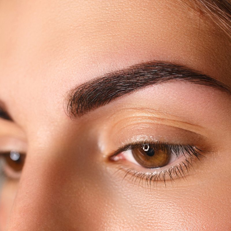 What Is Xanthelasma And How Can One Get Rid Of It?