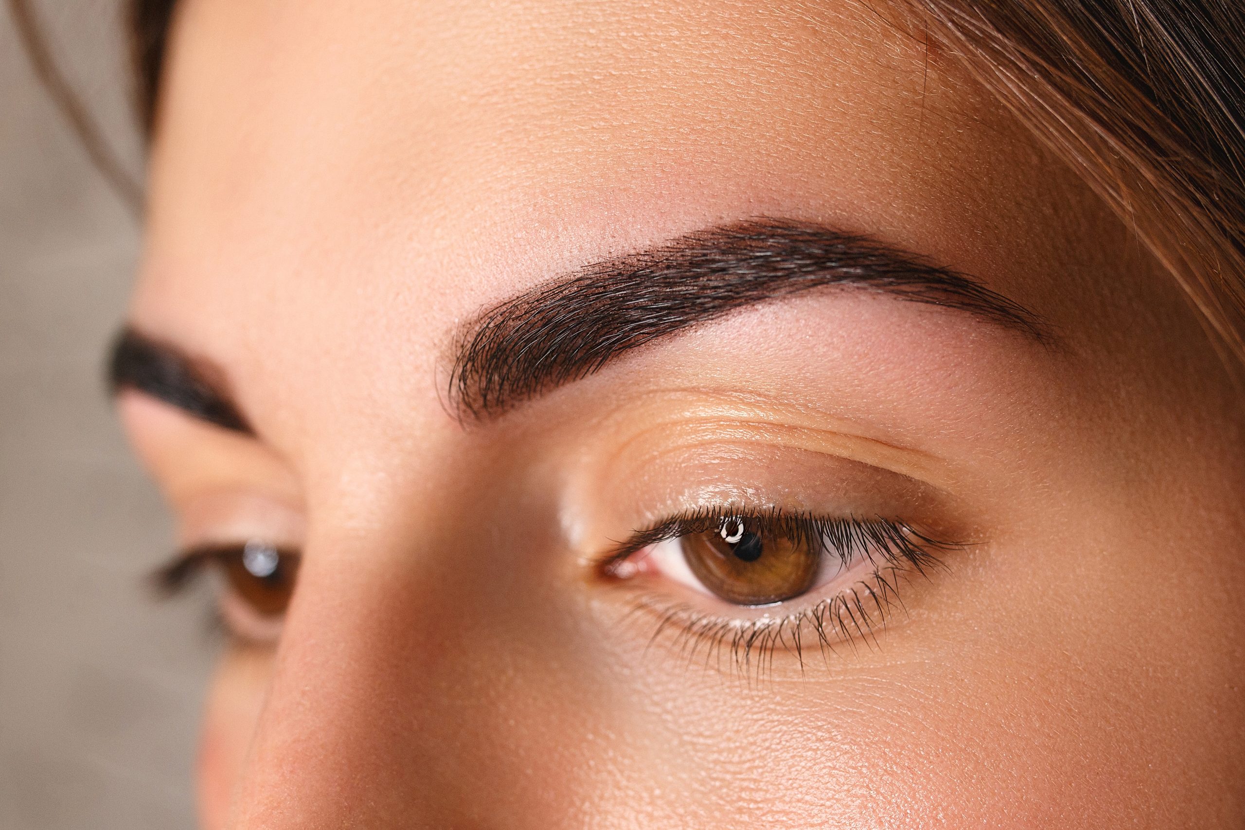 What is Xanthelasma and How to Get Rid of It?