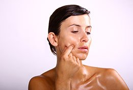 Oily Skin Before treatment small Image