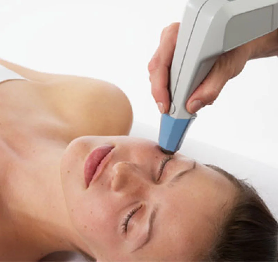 exilis face treatment