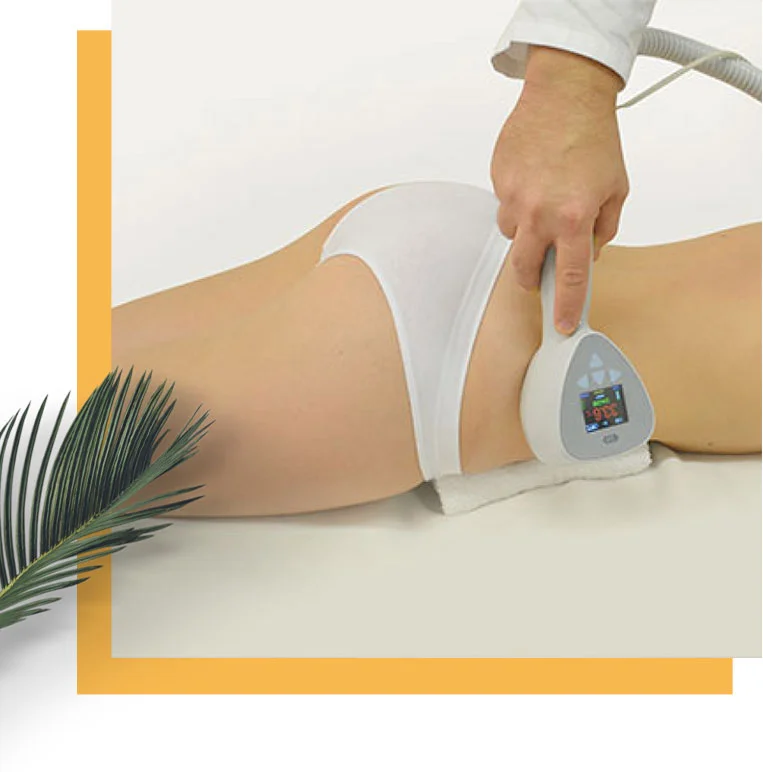 Exilis elite treatment