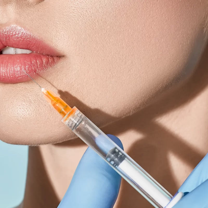 Lip Filler