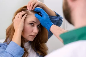 PRP Treatment for Your Receding Hairline