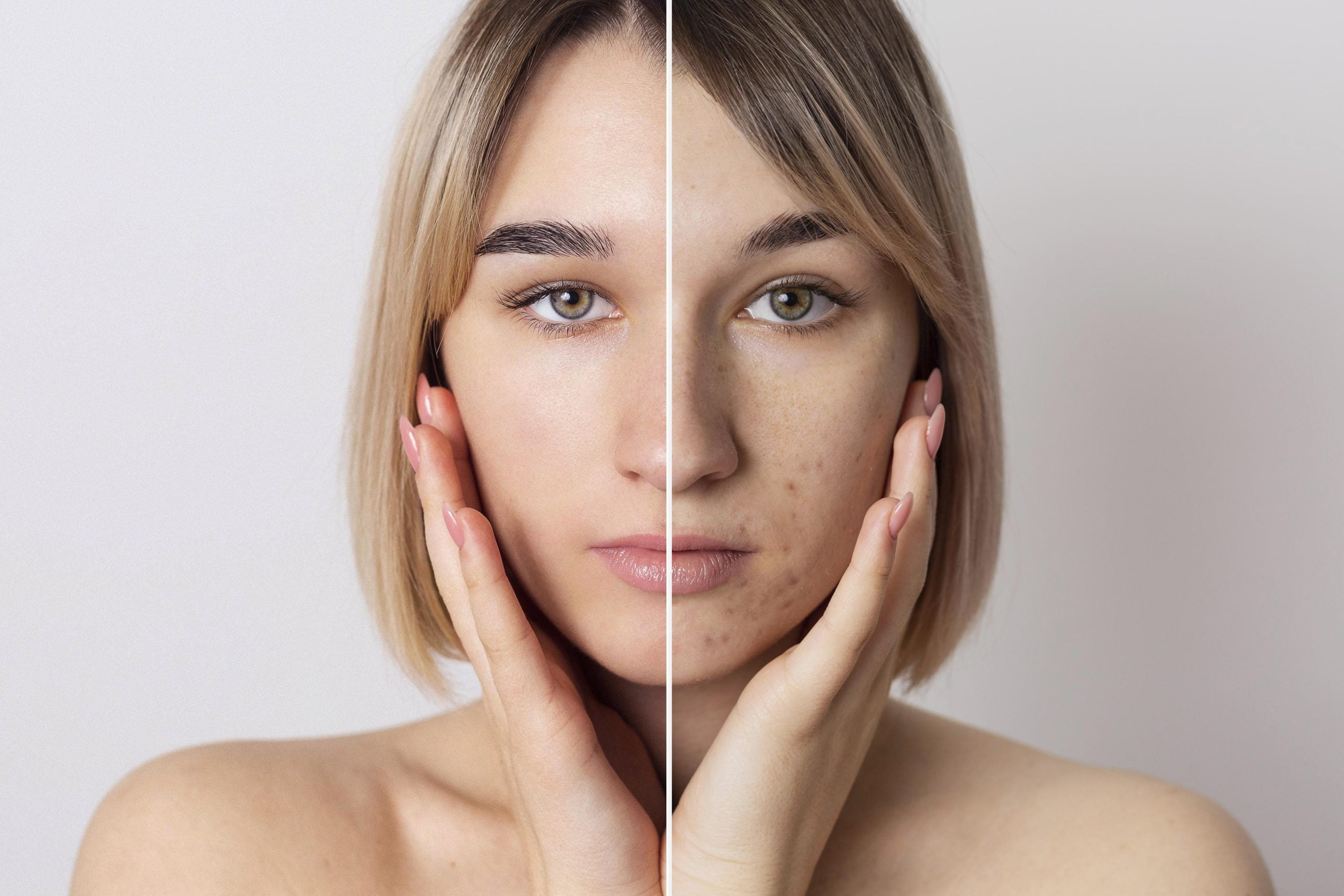 The Latest Skin Pigmentation Treatment You Need to Try!