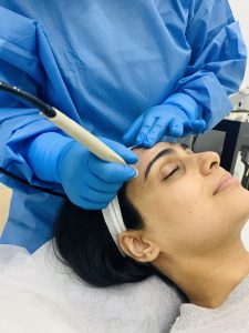 Skin Pigmentation Treatment  at AAYNA Clinic