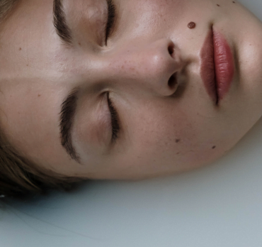 Transform Your Skin with Radiocautery Skin Tags Removal