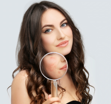 treat acne scars with fraxel laser at aayna