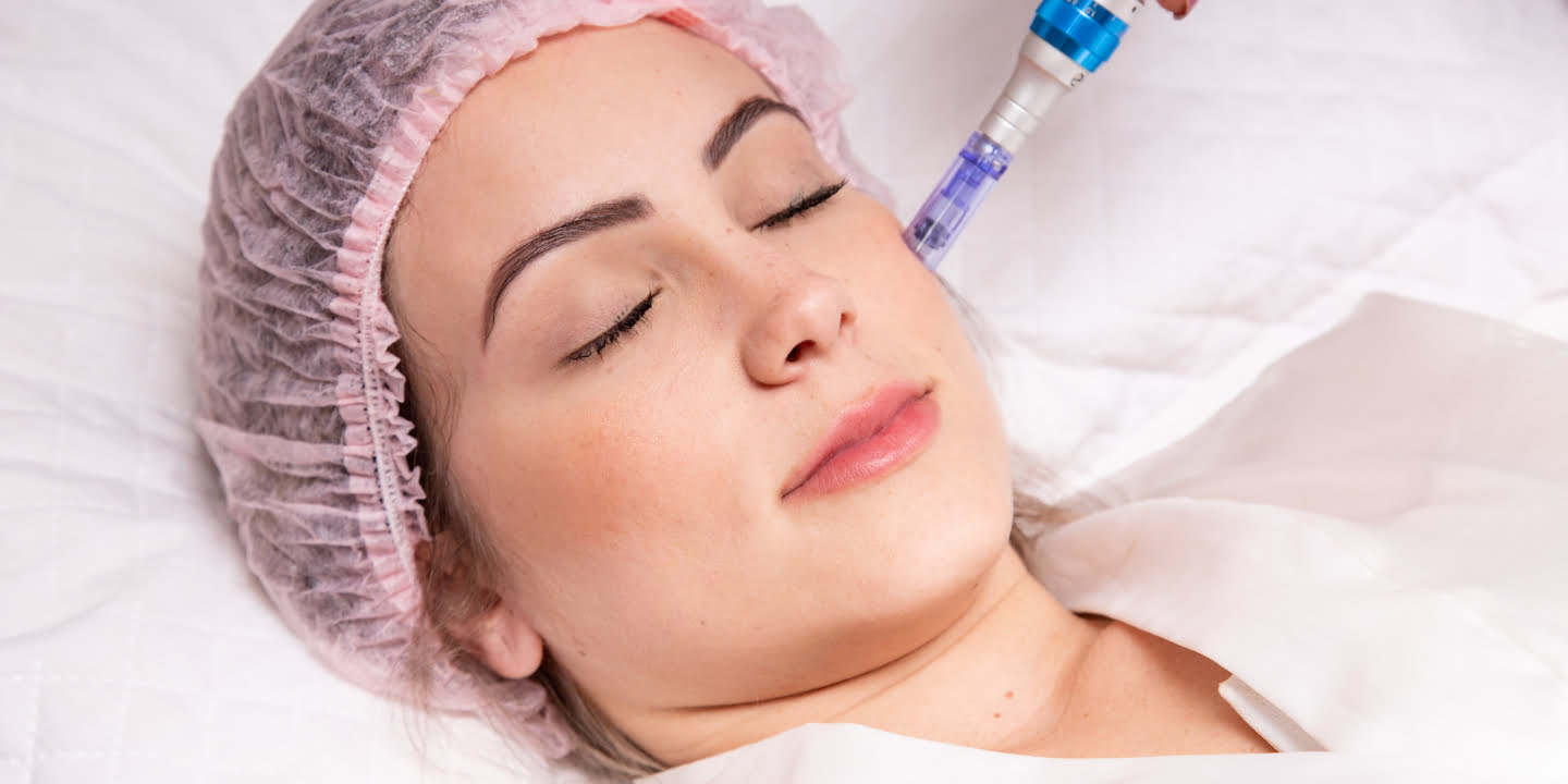 Dermapen (Microneedling) Treatment – Procedure, Results & Risks