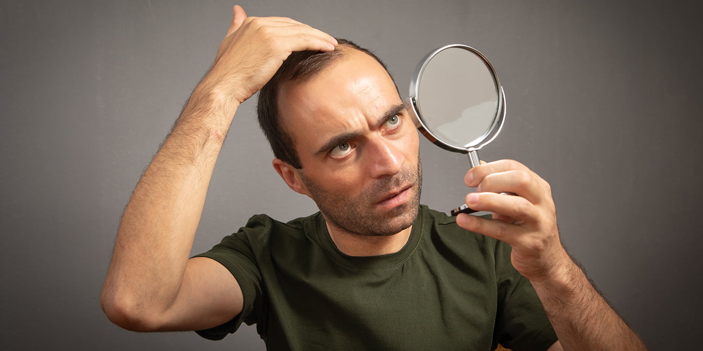 Hair Loss: 7 Potential Causes of Hair Loss and Baldness