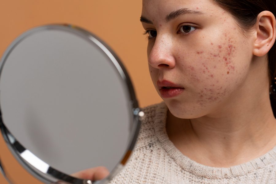 Dark Spots on Skin / Dark Spots on Face Treatment