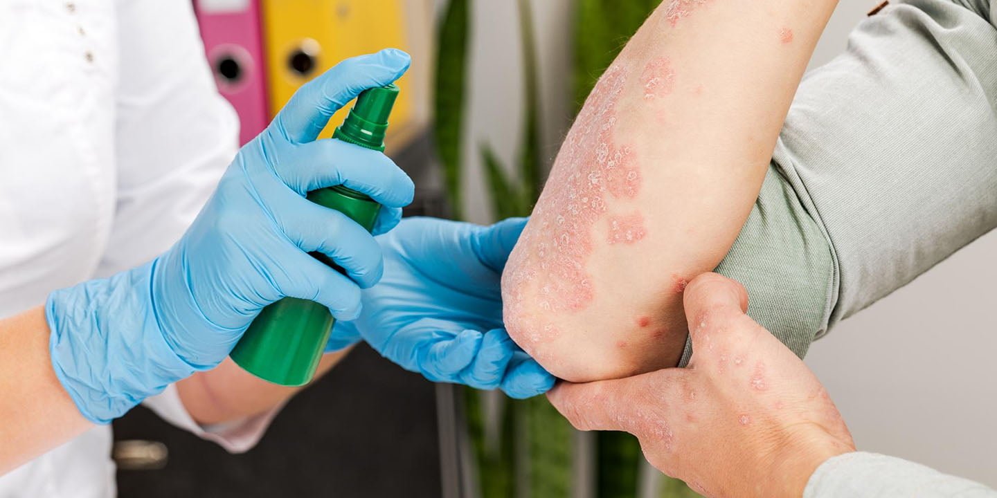 Fungal Infections with Medical Pedicures Tips and Solutions