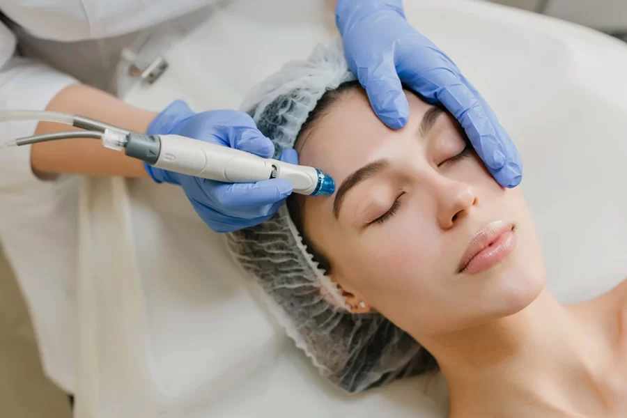 Is Hydra facial the best way for Acne Scars Treatment - AAYNA Clinic