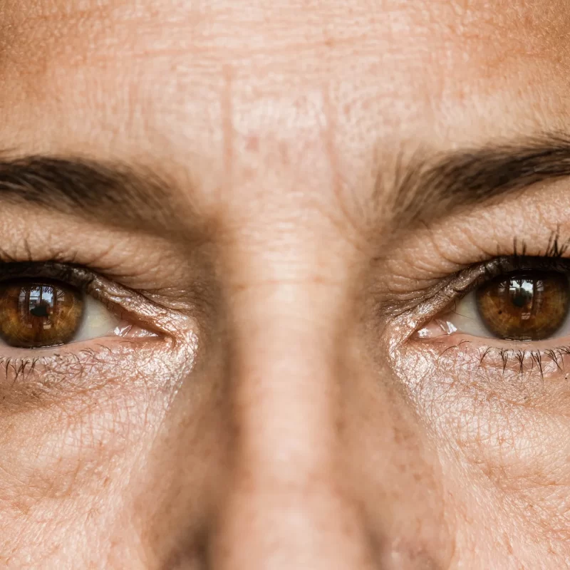 Eye Collagen Loss