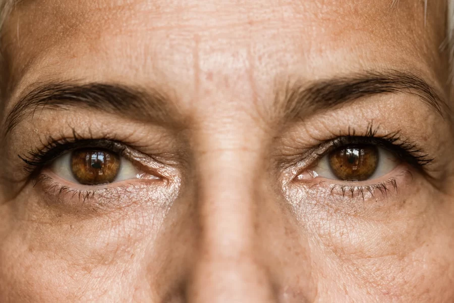 Eye Collagen Loss