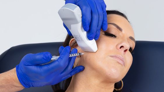 Slim Jawline, Stop Grinding: Benefits of Masseter Botox