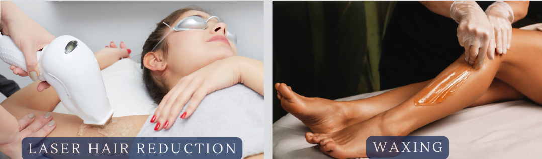 Laser Hair Removal vs Waxing: Which Option Suits You Best?