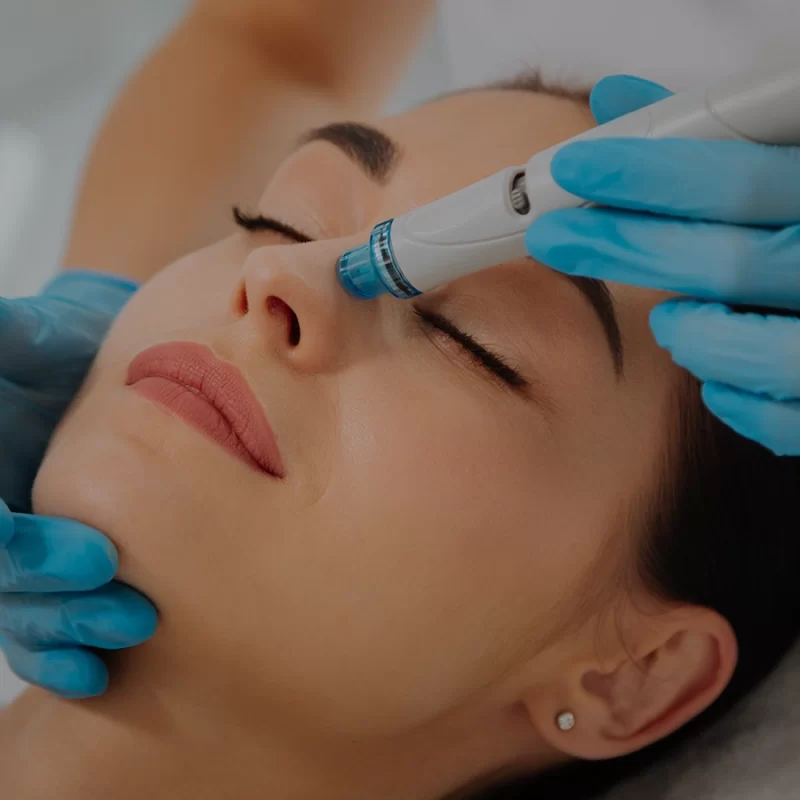 HydraFacial Side Effects: Are There Any?