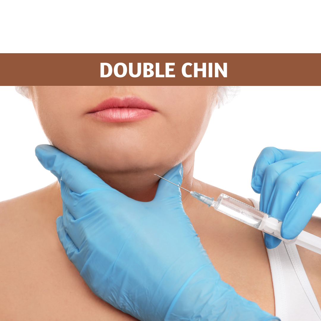 Double Chin Transformation: Fat Dissolving Treatments and More