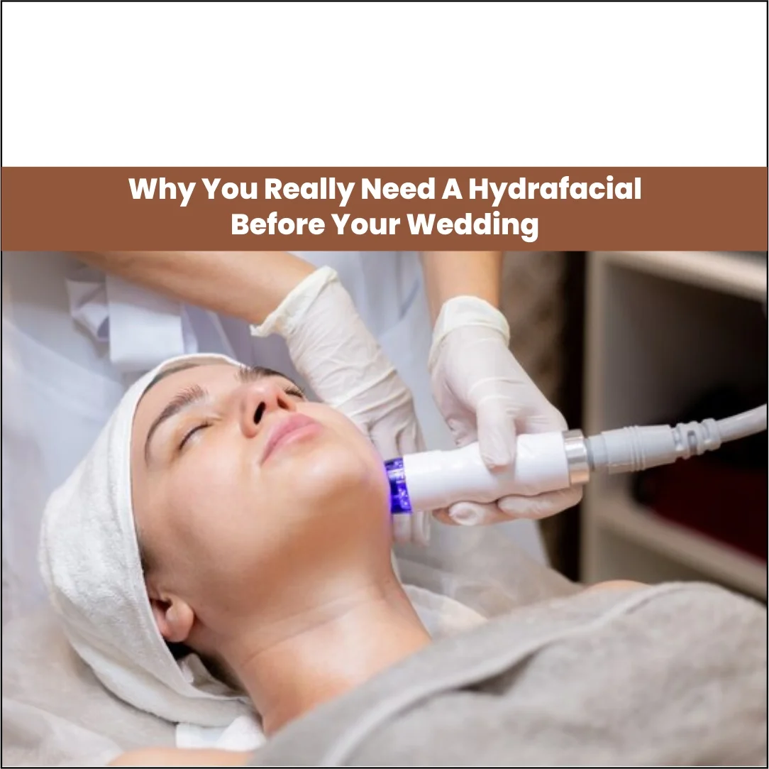 Do You Really Need a HydraFacial Before Your Wedding? AAYNA Clinic
