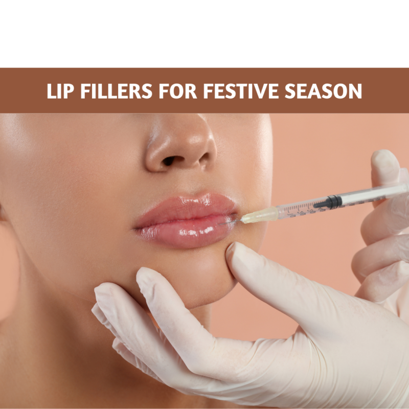 Lip Fillers for Festive Season