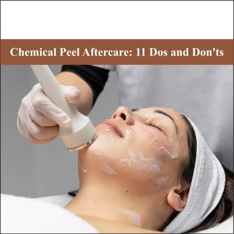 Chemical Peel Aftercare