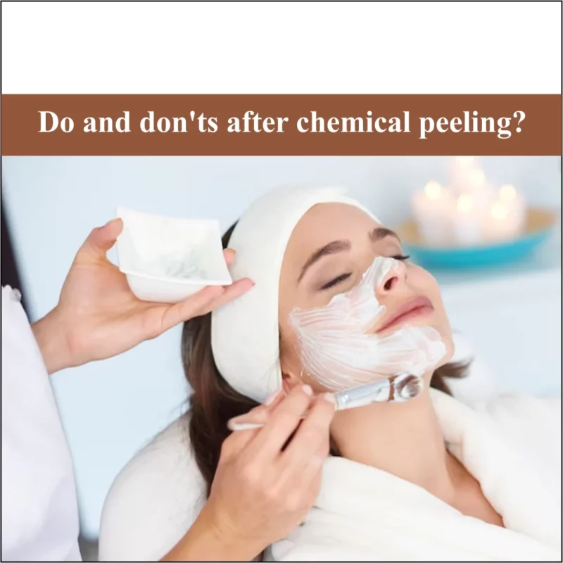 Do and Don'ts After Chemical Peeling