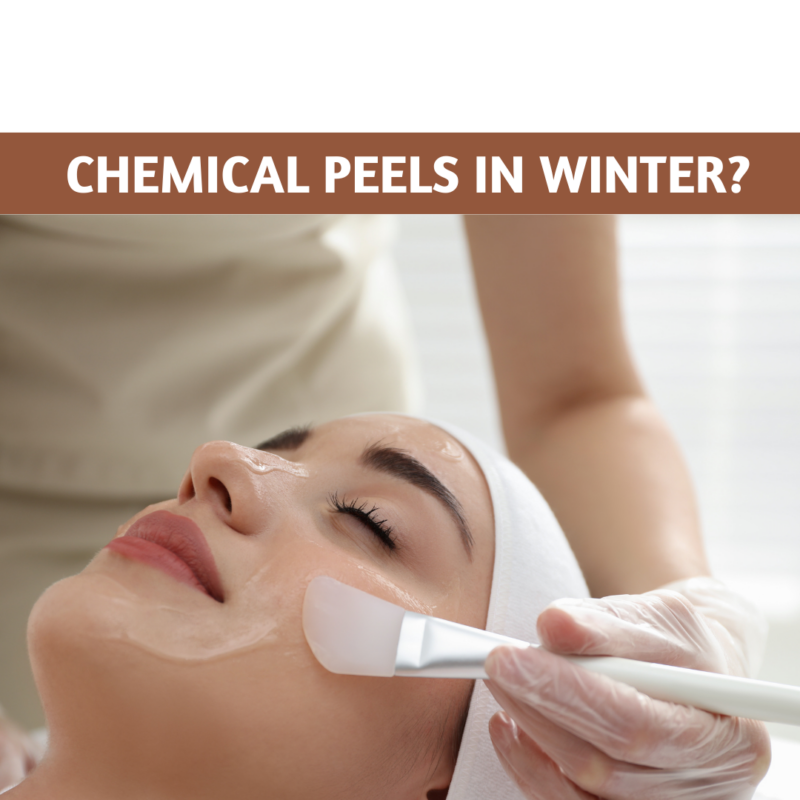 Chemical peels in winters