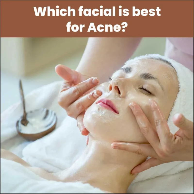 Which facial is best for Acne?