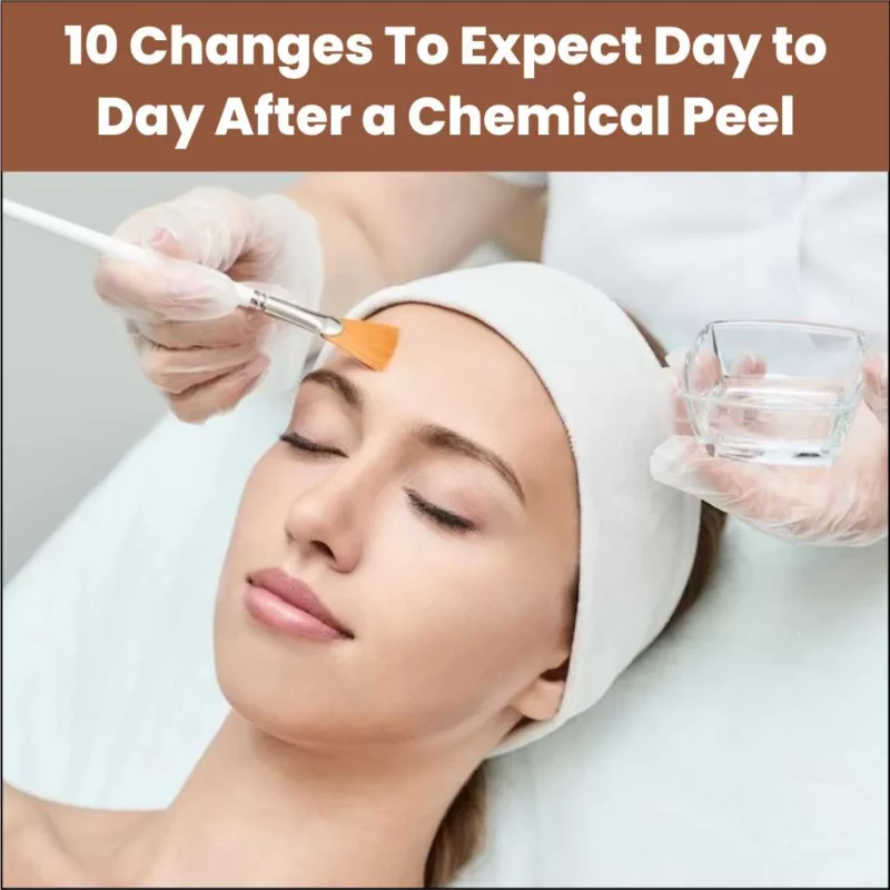 Changes To Expect Day to Day After a Chemical Peel