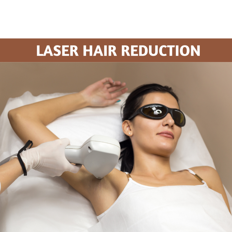 Laser hair reduction