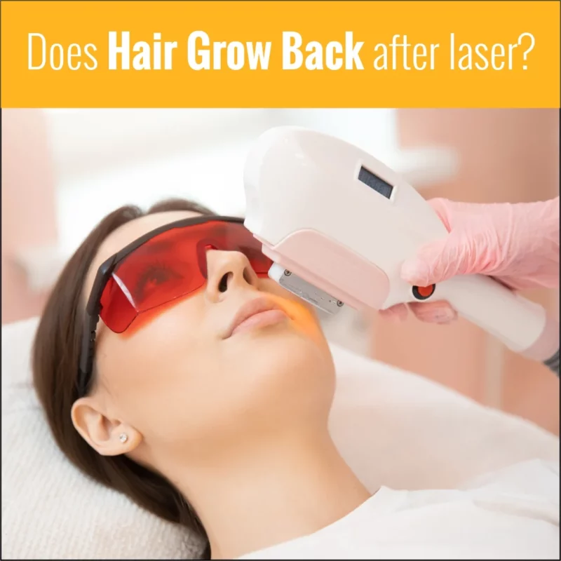 Does Hair Grow Back After Laser Hair Removal?