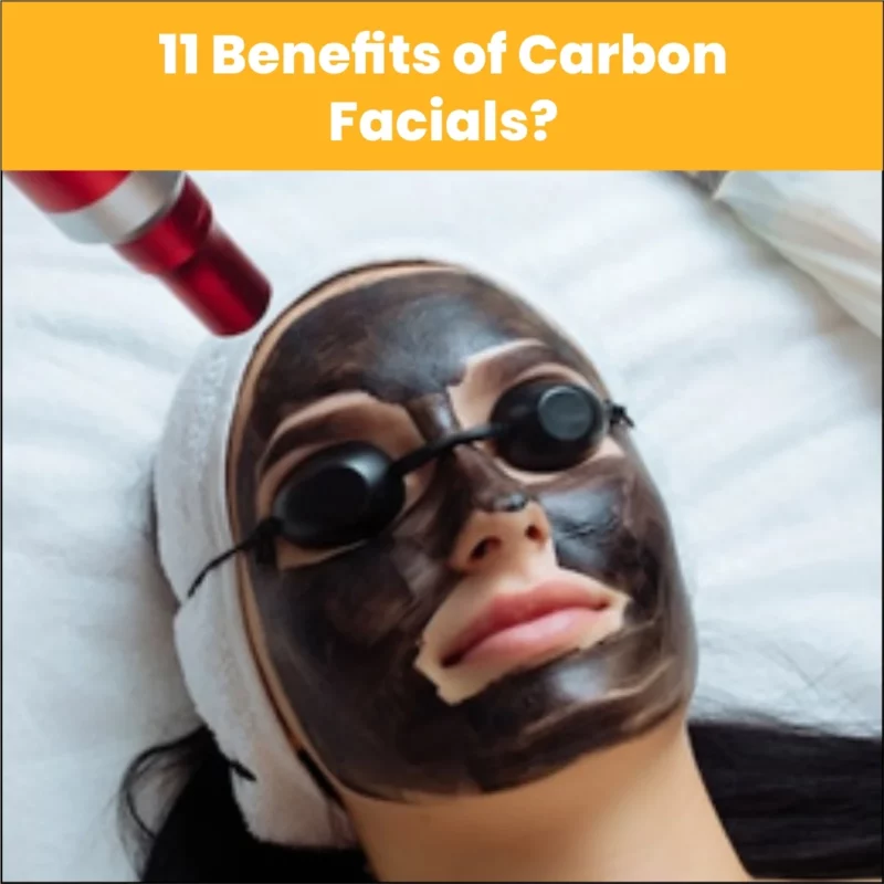 11 Benefits of Carbon Facials