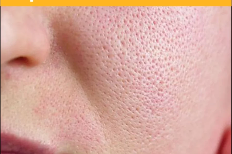 Tips to Reduce Pores