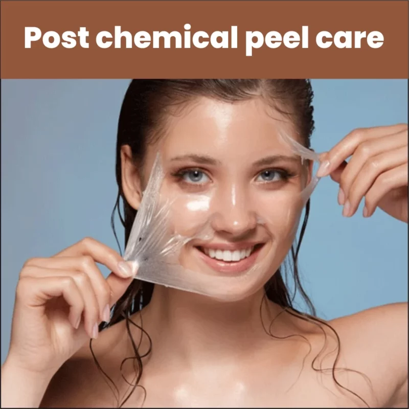 Post Chemical Peel Care