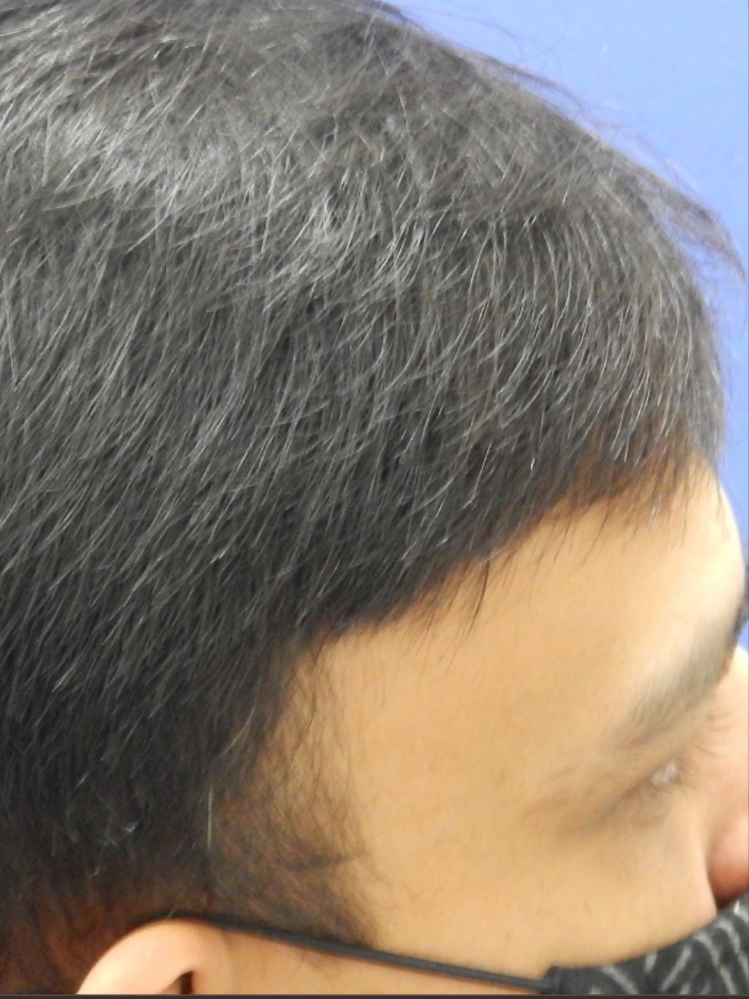 after-img