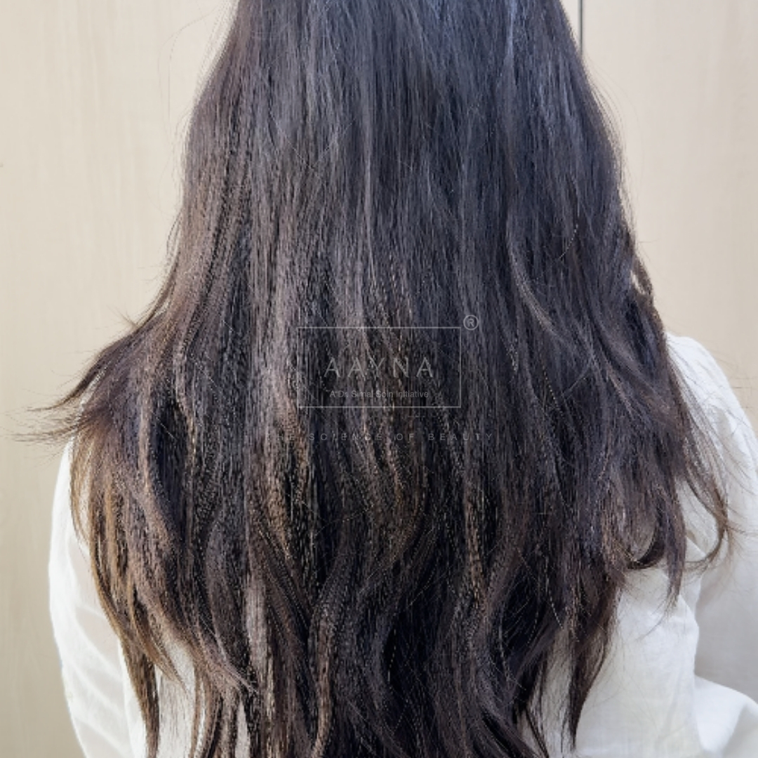 before-img