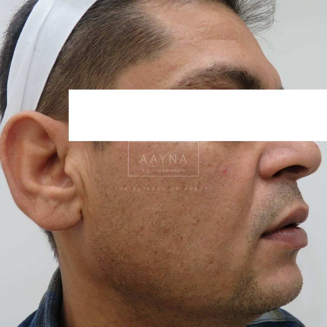 before-img