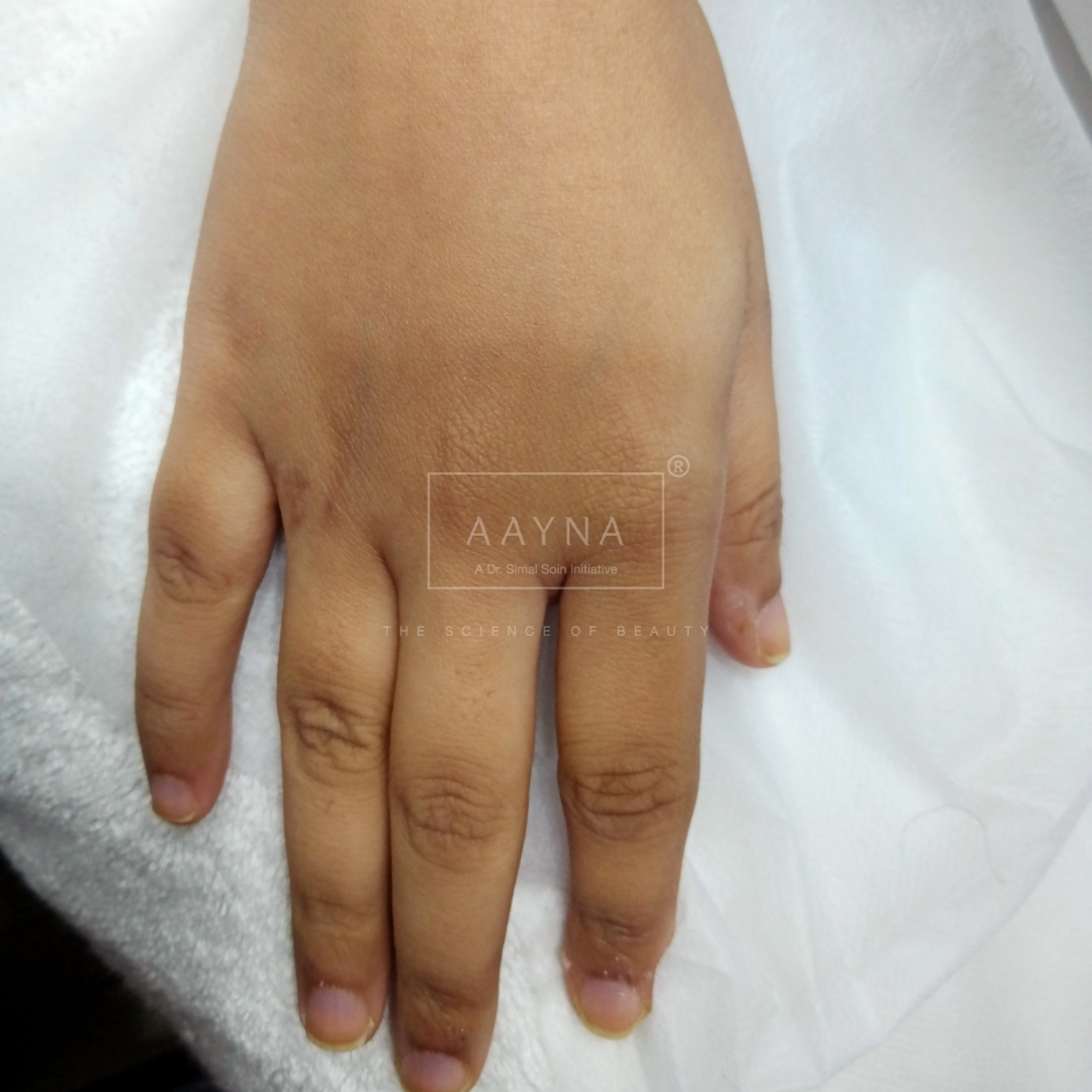before-img