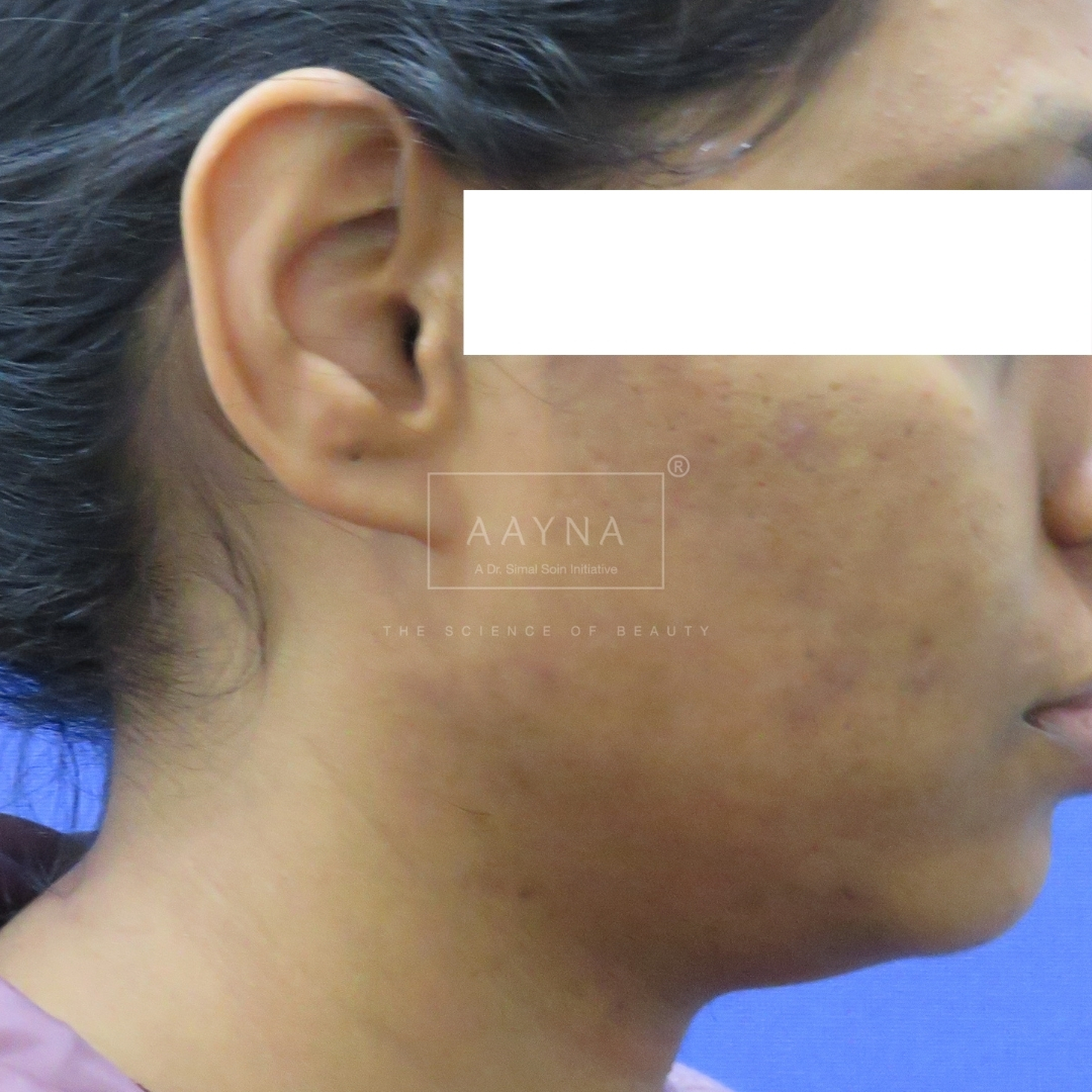 before-img