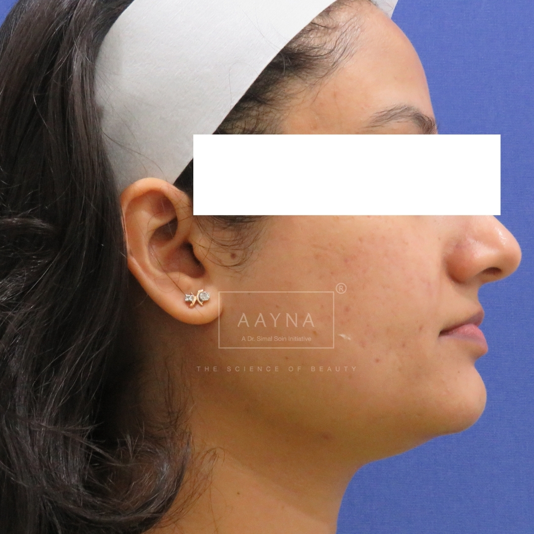 before-img