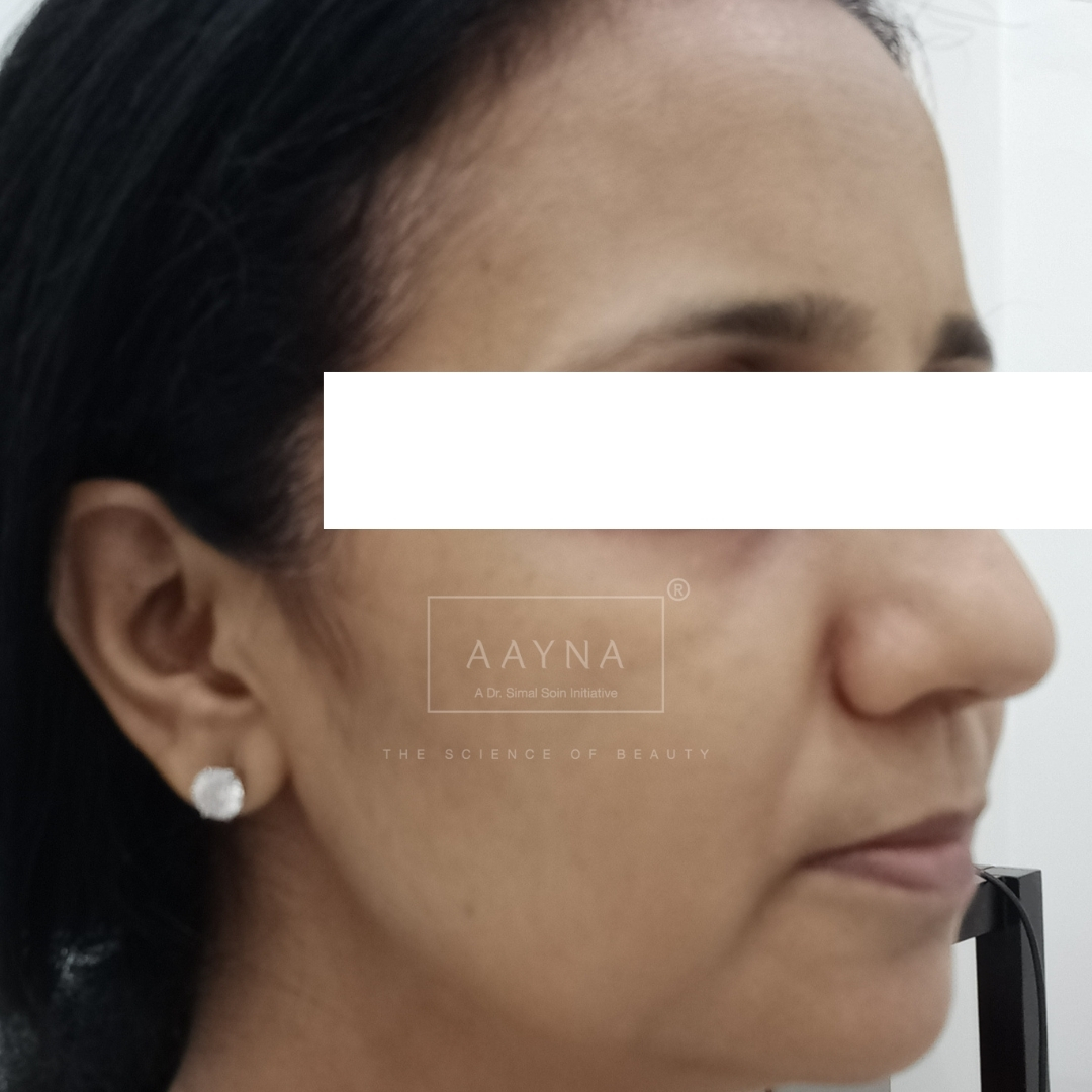 before-img