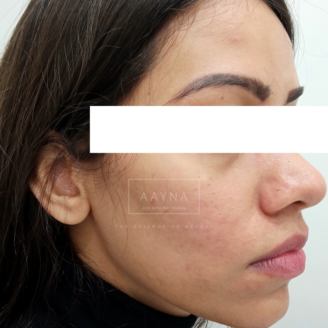 before-img