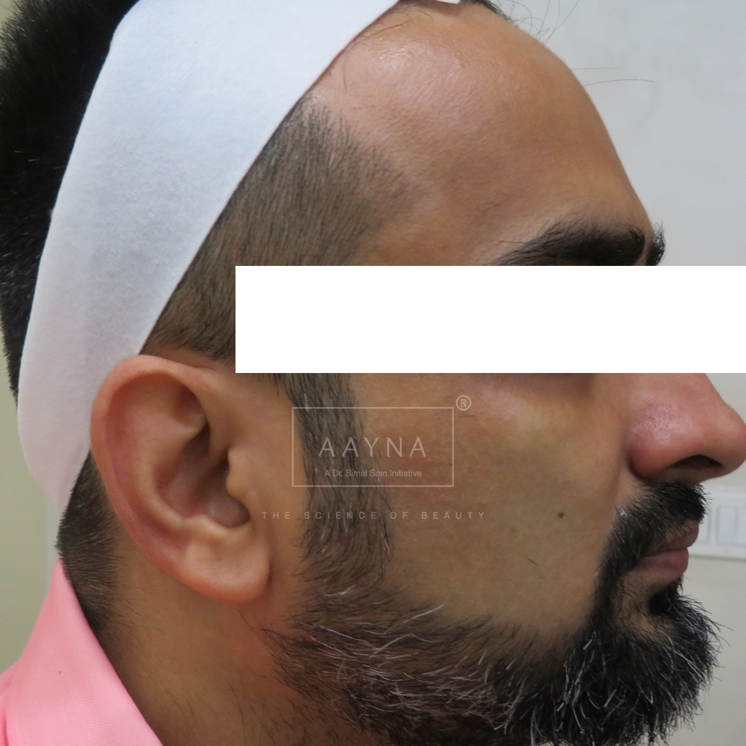 before-img