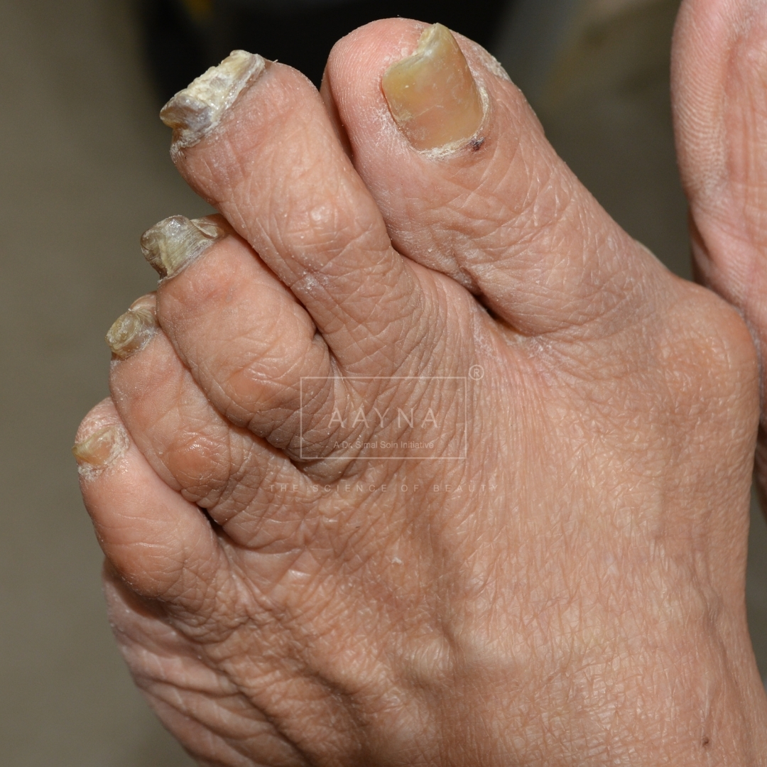 before-img