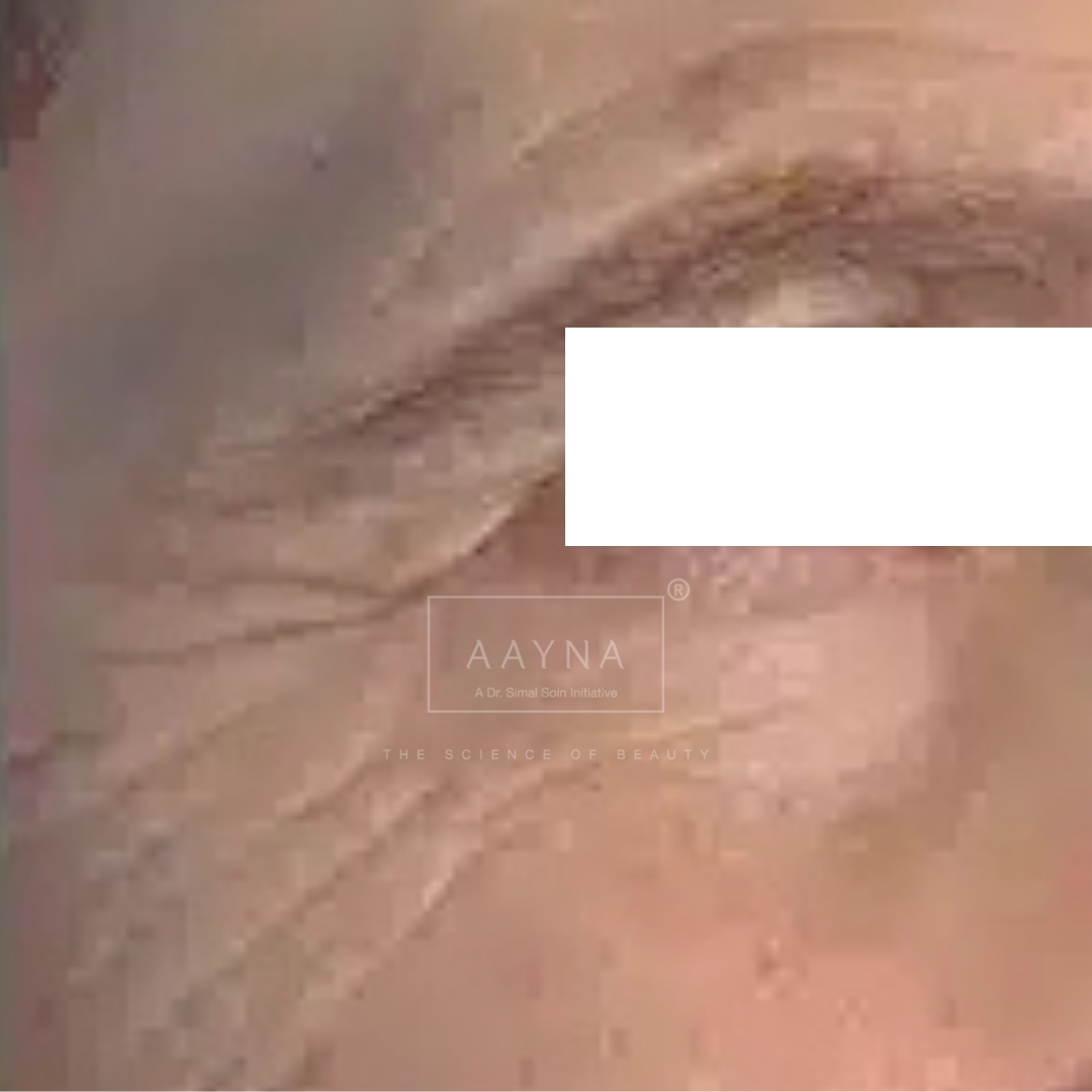before-img