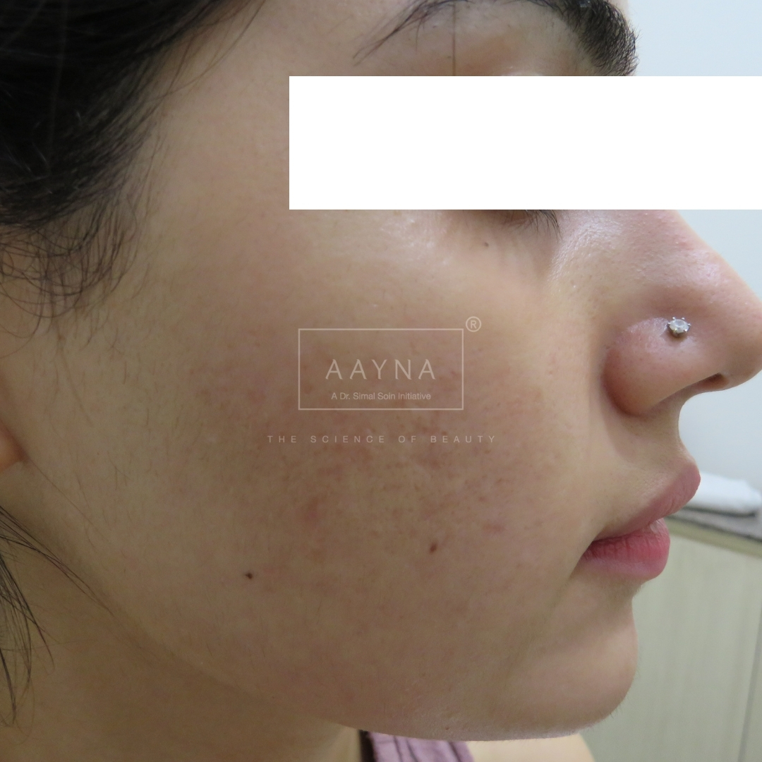 before-img