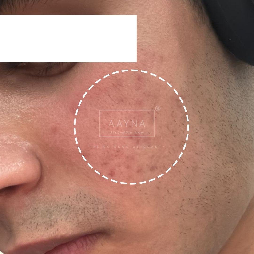 before-img
